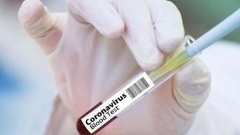 Коронавирусқа қарсы вакцина 2021 жылдың бірінші жартысында нарыққа шығады